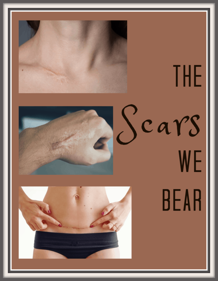 The Scars We Bear